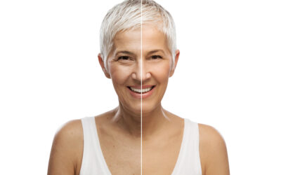 Botox Injections for Wrinkles: What You Need to Know