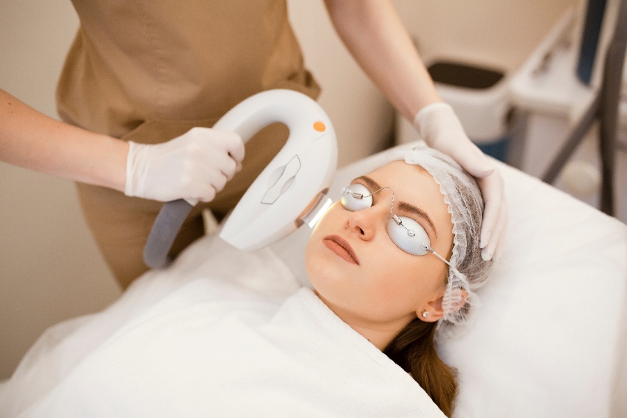 IPL treatment