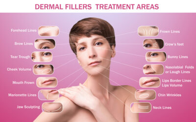 Benefits of Dermal Fillers: Restore Volume and Enhance Natural Beauty