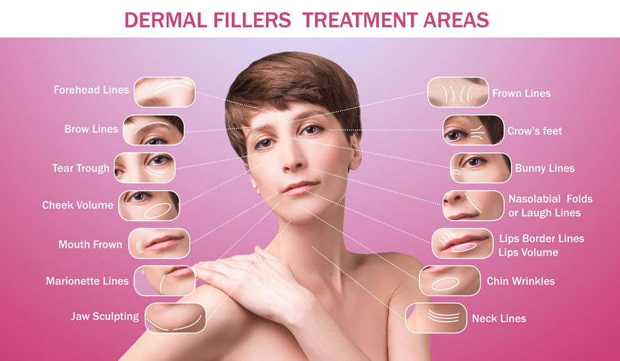 Benefits of Dermal Fillers: Restore Volume and Enhance Natural Beauty